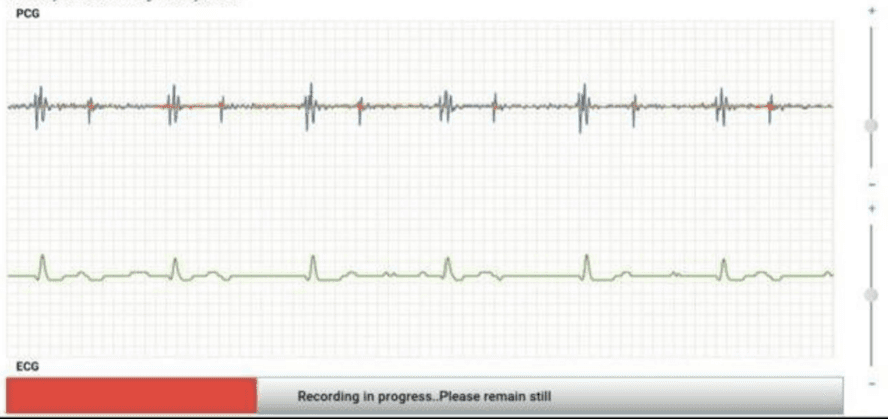 Simultaneous visualization