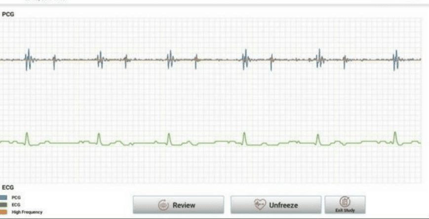 Review after recording
